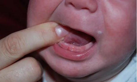 Chews: The Must-Have for Your Teething Baby